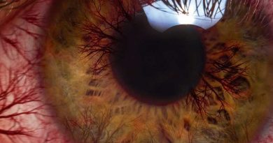 Descubriendo los Mitos y Realidades del Glaucoma